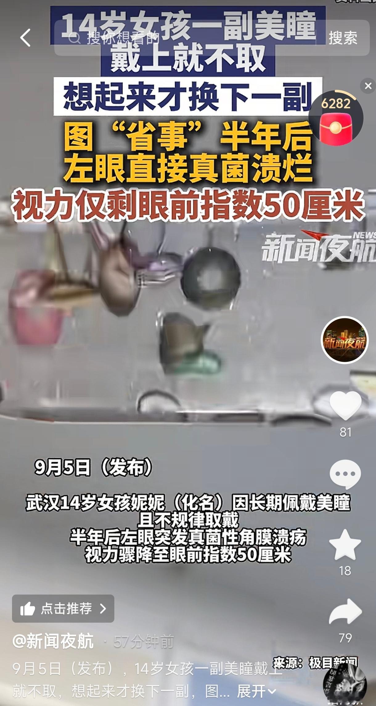 湖北武汉，一14岁女孩爱上戴美瞳，戴上后就不摘下来，晚上睡觉也不取，第二天继续用