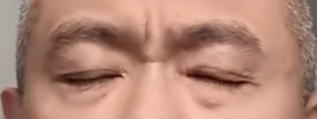 年纪越轻，山根横纹的摧毁力越大 