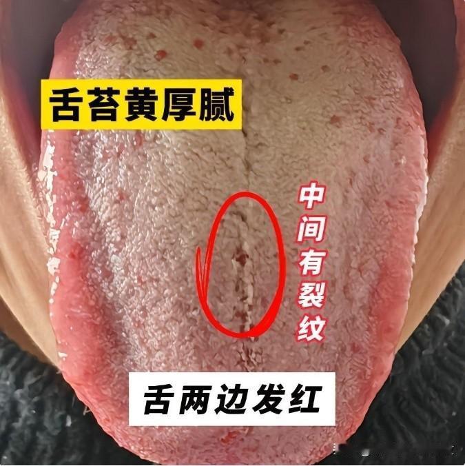 这小兄弟才29，看起来跟熊猫一样，顶着两个黑眼圈，毫无精气神[熊猫][熊猫][熊