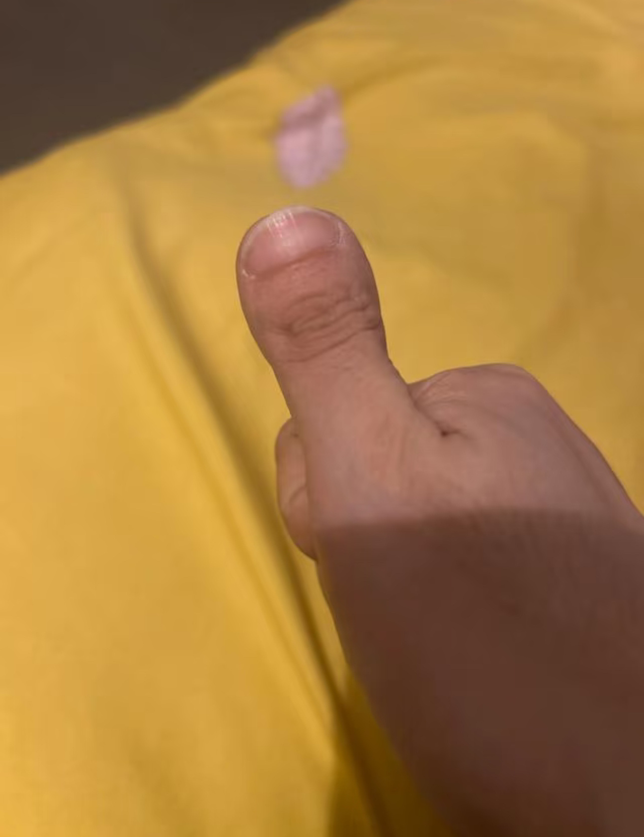 原来手指也能矫正，这种小众的变美矫正会有点贵，一个手指2万两个手指3.5万。 