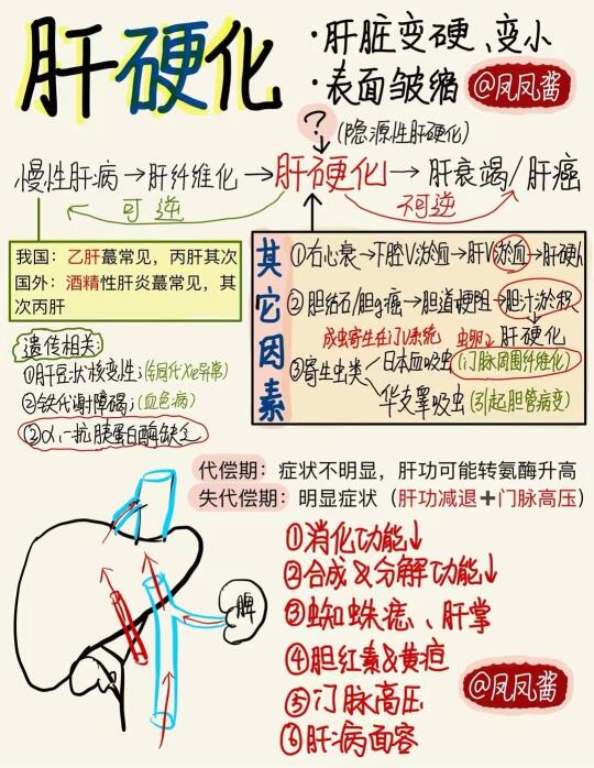 📖医学生笔记｜肝硬化 建议点赞收藏🔥