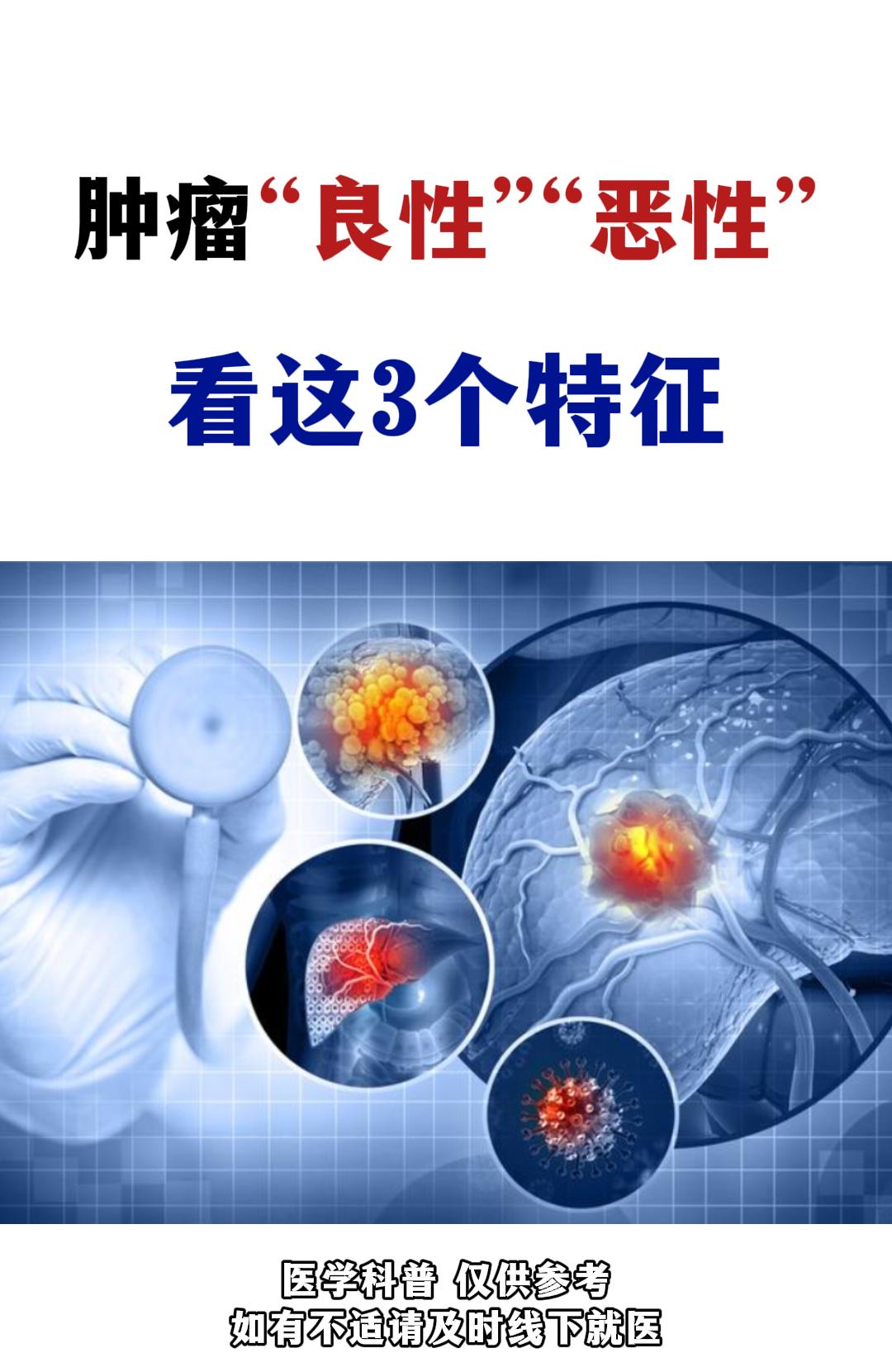 肿瘤良性恶性，看这3个特征。