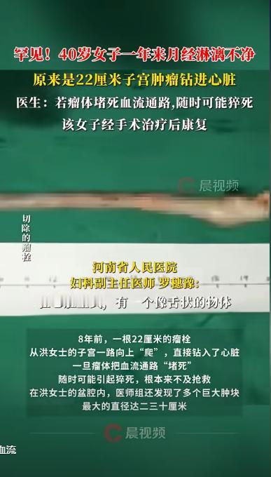 太震惊了！河南的一位40岁的女子，因月经异常多次就医，然而一直未能查出病因。最终