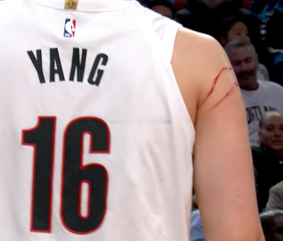 哎呀妈呀这大血印子杨瀚森