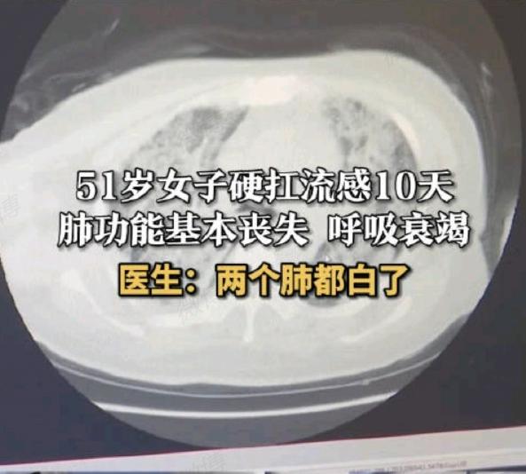 #女子硬扛流感10天两个肺都白了# 近日，江苏一位51岁的陈女士感染了流感，她在