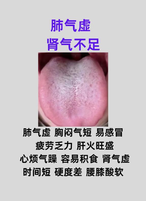 身体总调理不好？可能是这 4 种复合体质