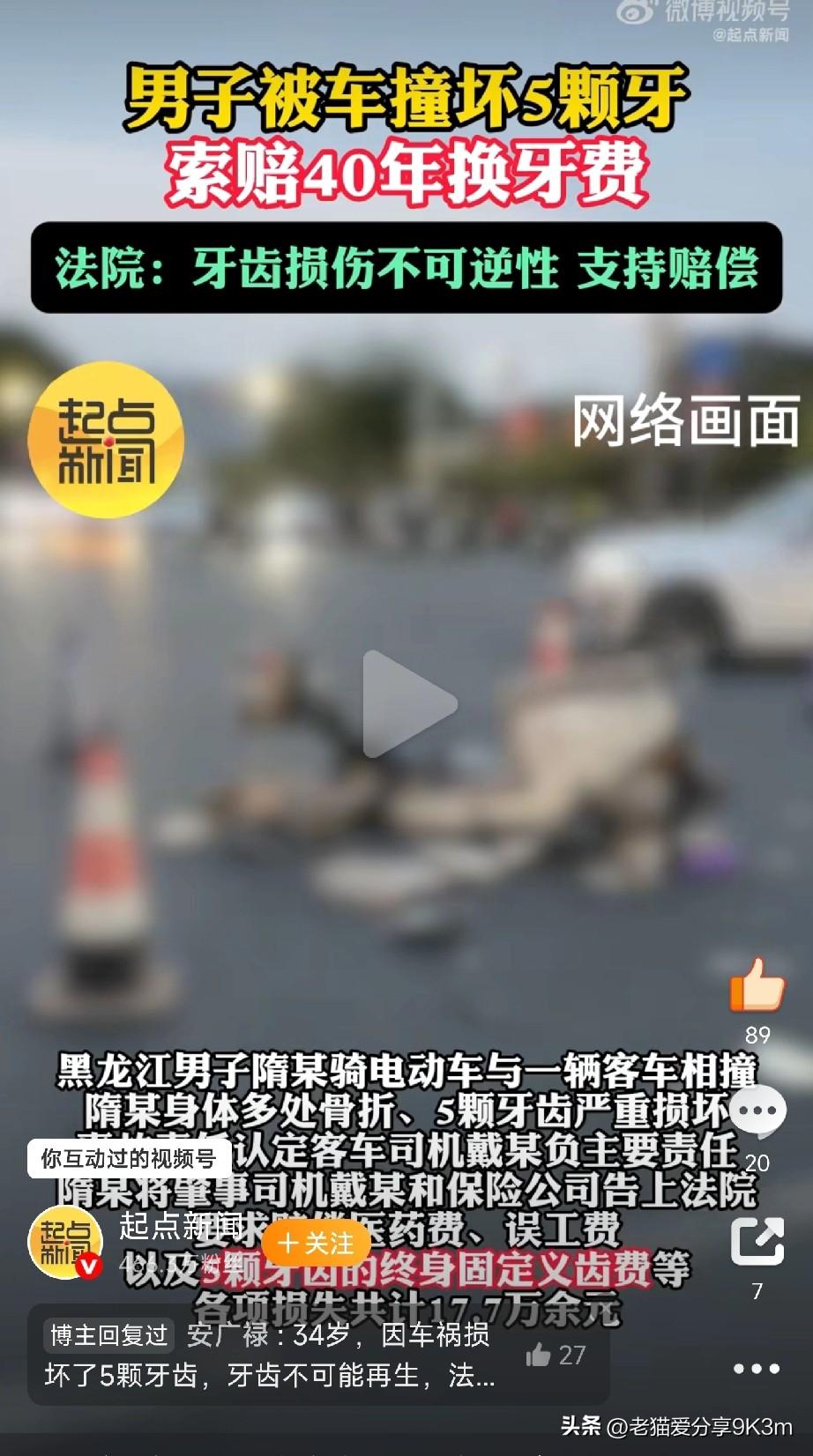 被车撞掉5颗牙，索赔40年换牙费，法院真给撑腰了！
 
黑龙江大庆的隋某，34岁