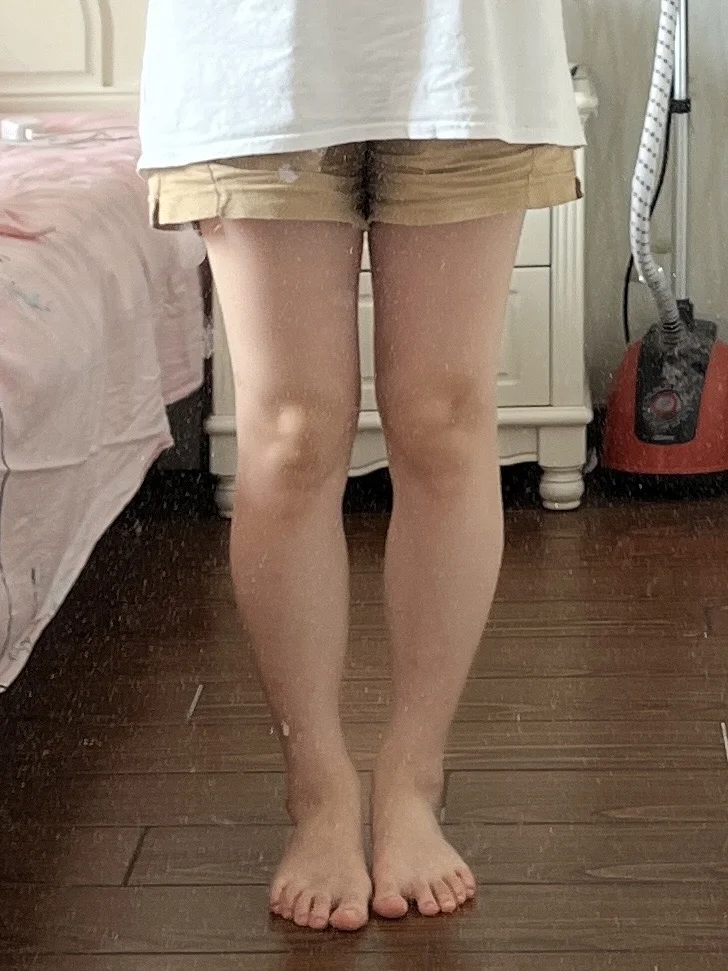 瘦腿成功✌️live对比