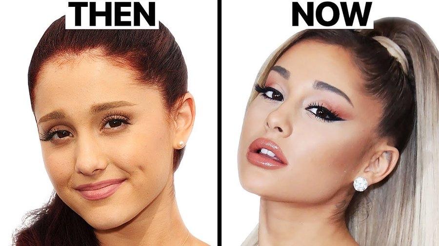 Ariana Grande也就是大家说的A妹，很多人猜测她做了不少整容项目。从她