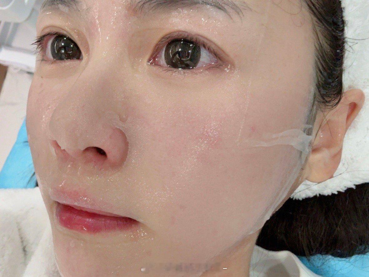 每次做完皮肤就什么都想开了，想活的心都没了[泪]1000发 一发25针…我都成筛