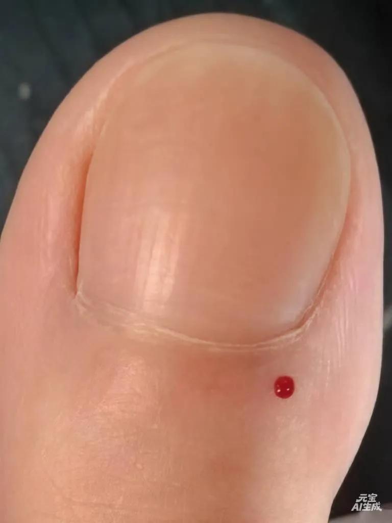 立春时节扎大墩～
（江苏省人民医院梅花独秀医生）
我个人并不明白为何要扎针，只晓