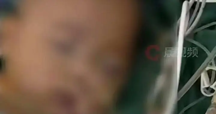 术前术后全是问题，5月龄女婴离世问责不是终点|新京报快评