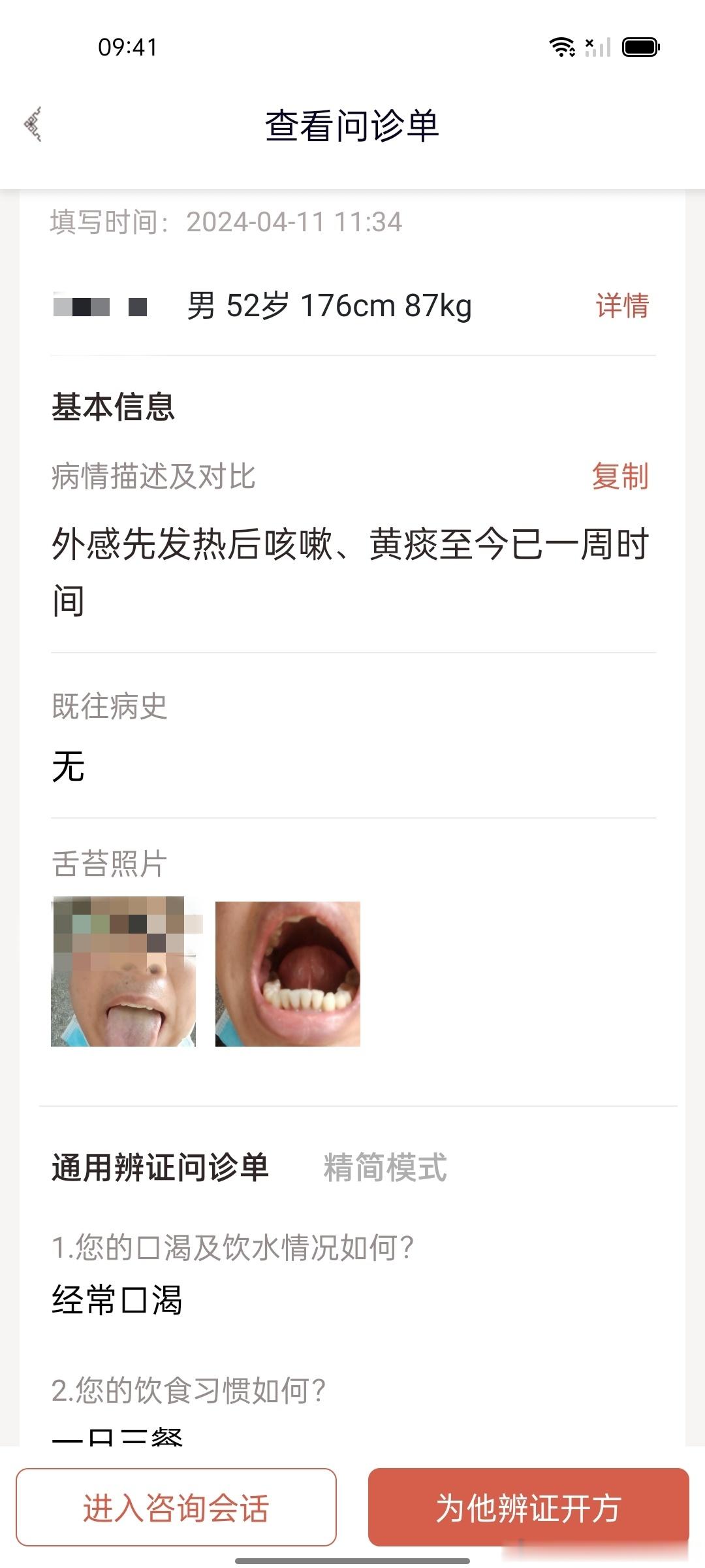 #肥猫治成人肺炎支气管炎#  【现在肺炎依然高发，不管小儿还是成人还是要拍片子，