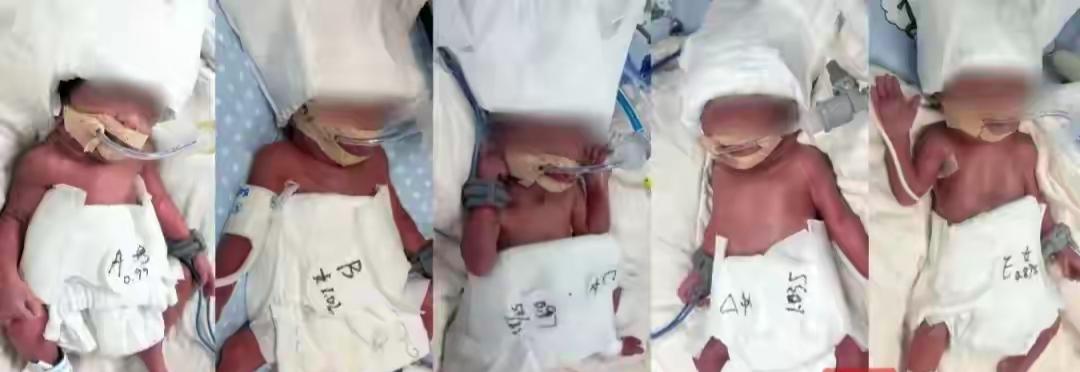 最近看到一则超暖心的新闻。有位张先生，他老婆李女士刚诞下五胞胎。这五胞胎可是极为