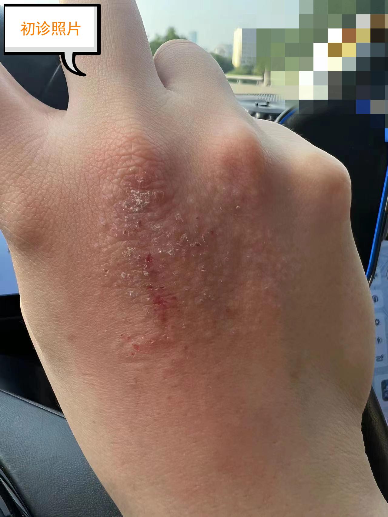 学中医学的是眼光，用经方炼的是思维

来源网络

一女性患者，32岁，体型偏瘦，