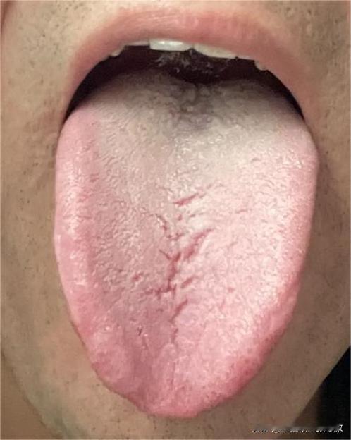让你管住自己就是不听，吃不好，睡不好，男科也不好了[撇嘴][撇嘴]

昨天让我看