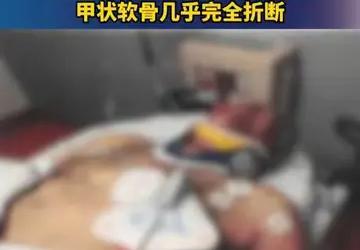 爱泼斯坦“自缢”后照片首度公开，由此可以看出，美国的政治博弈已经达到了高潮，美国