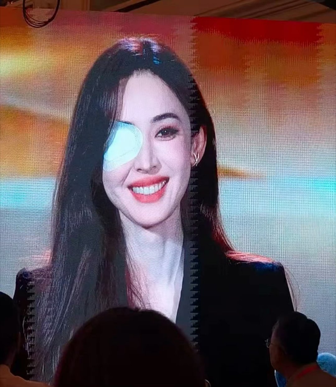 娜扎右眼贴纱布明明眼睛不适需要静养，却依旧认真走完整场活动，言语间还在为状态不佳