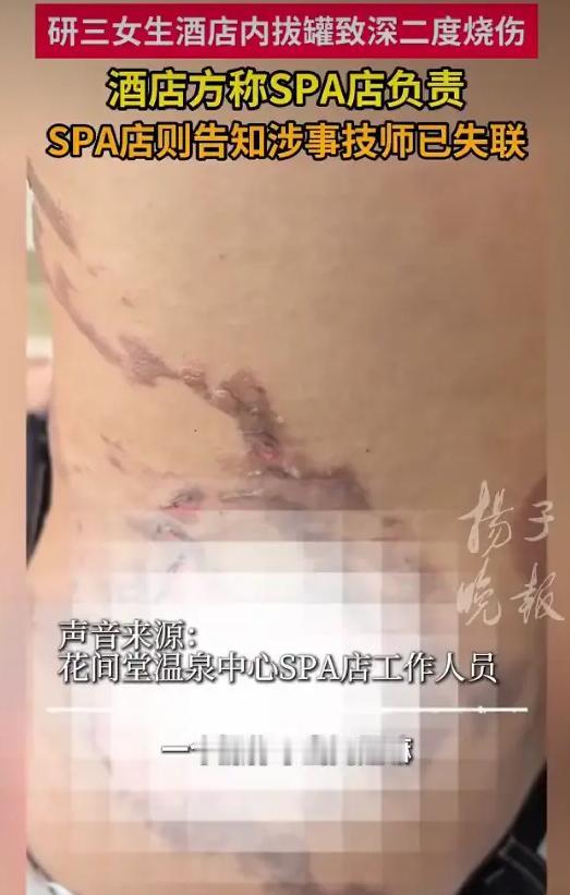 湖北武汉，女生跟朋友去酒店里开房，办理好入住后，女子准备去酒店的养生馆做个 sp