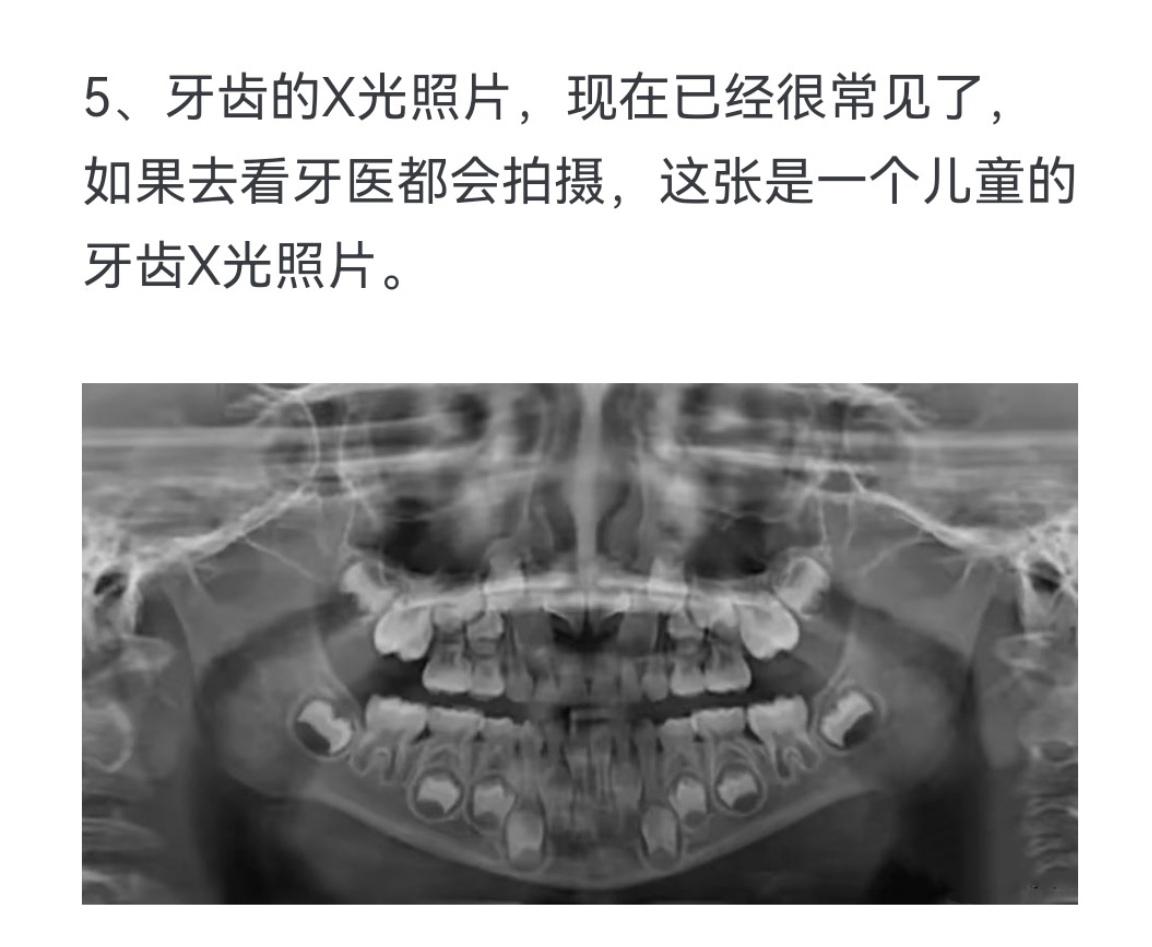 来自各个物体的X光照片