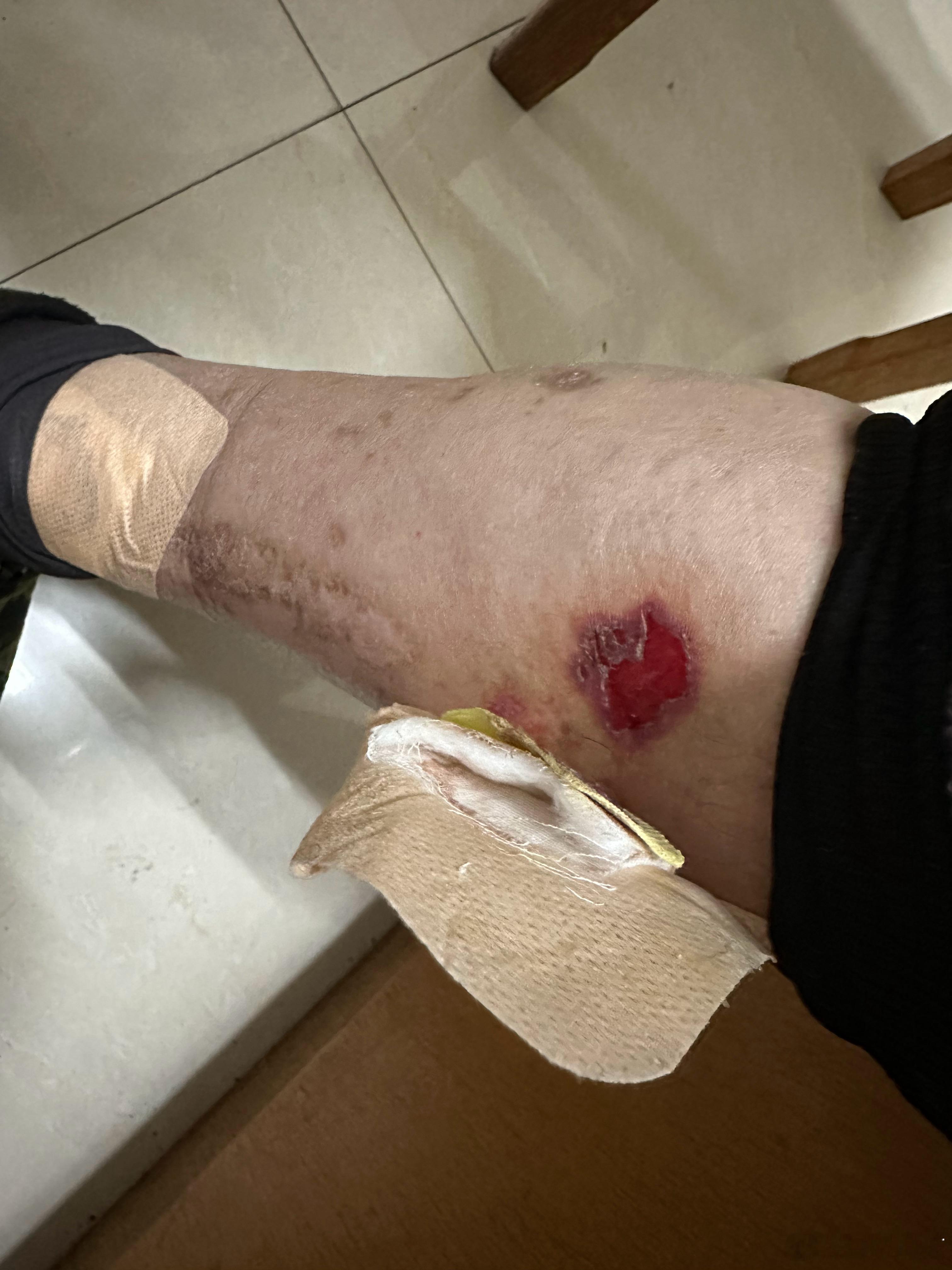 今天门诊遇到一位69岁老汉，只是来开个换药的单子而已，他的要求也就这么简单。他前