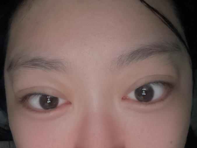 大家哭完眼睛都这样吗也太肿了吧救命🆘 ​​​