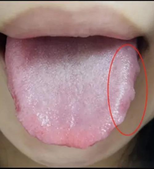 我曾800次提醒：健脾前不看肝气通不通？那你吃的补药全白费，脾还没好，人先垮了！