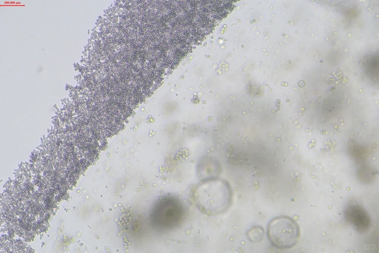 类器官培养 | 常见污染锦集