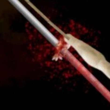 乙赖一还40抽，不然离身就被这样 