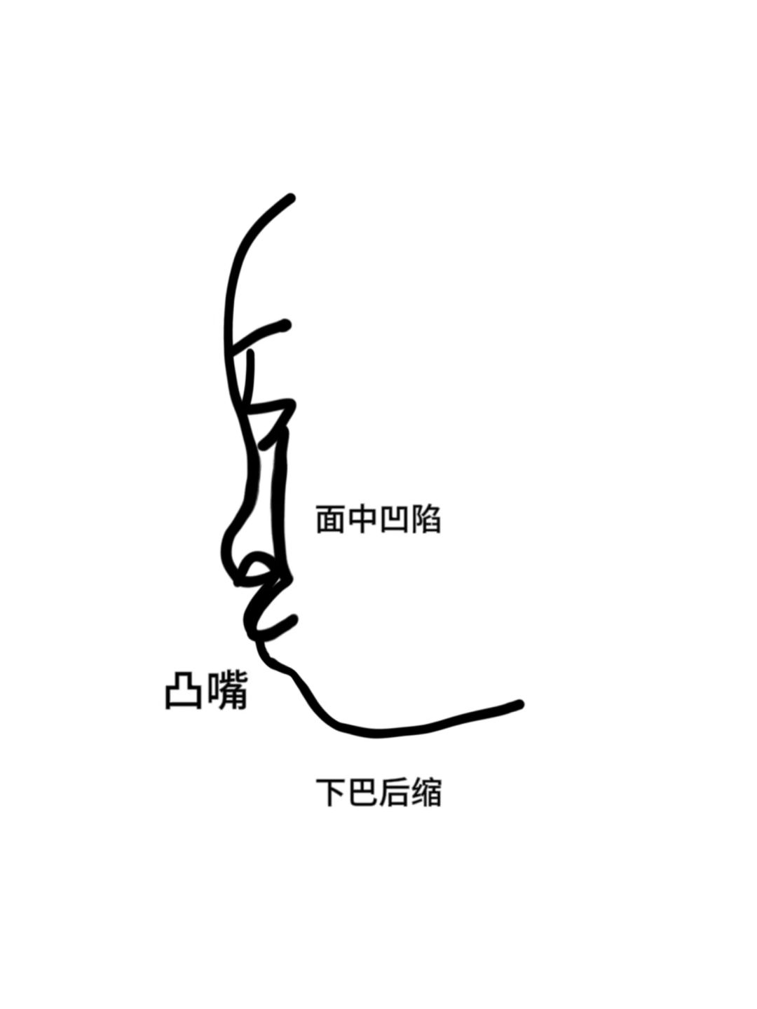 突然悟到这种骨性嘴凸怎么遮才能不凸了！！