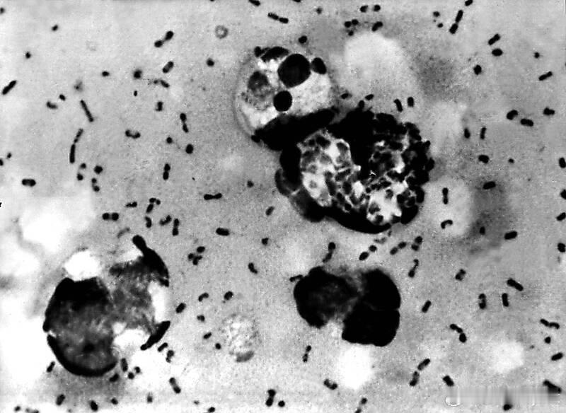 【火山喷发引发“骨牌效应”？研究揭示中世纪黑死病背后的“完美风暴”】海外新鲜事 