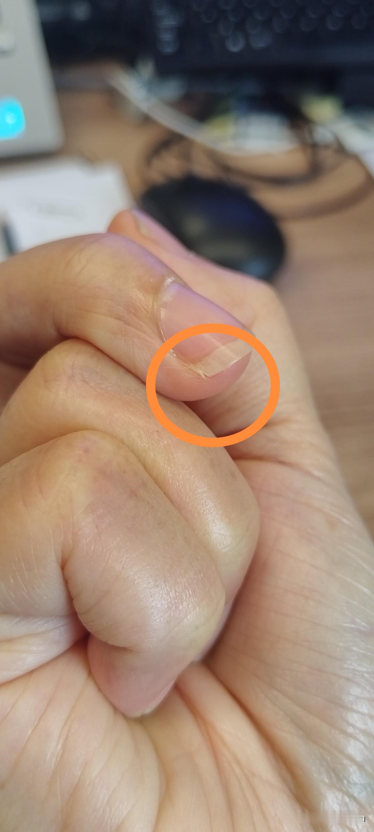 指甲长不了一点点。
稍微长长点，就出现这种小分叉，不知道这是怎么回事，我看同事的