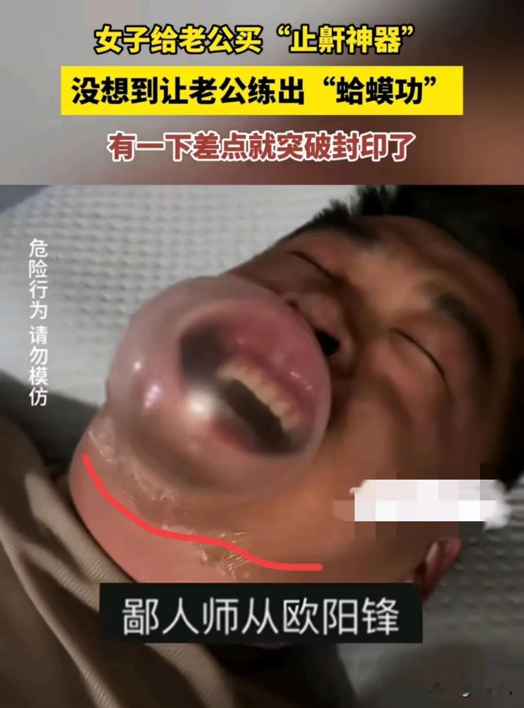 惊呆了！黑龙江哈尔滨一女士，不堪丈夫的打鼾声，从网上给丈夫买了一个止鼾神器！晚上