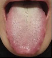 肾虚调理不难，但碰到肝郁肾虚，那可真是个“棘手活儿”！
 
　　尤其是男人，过了