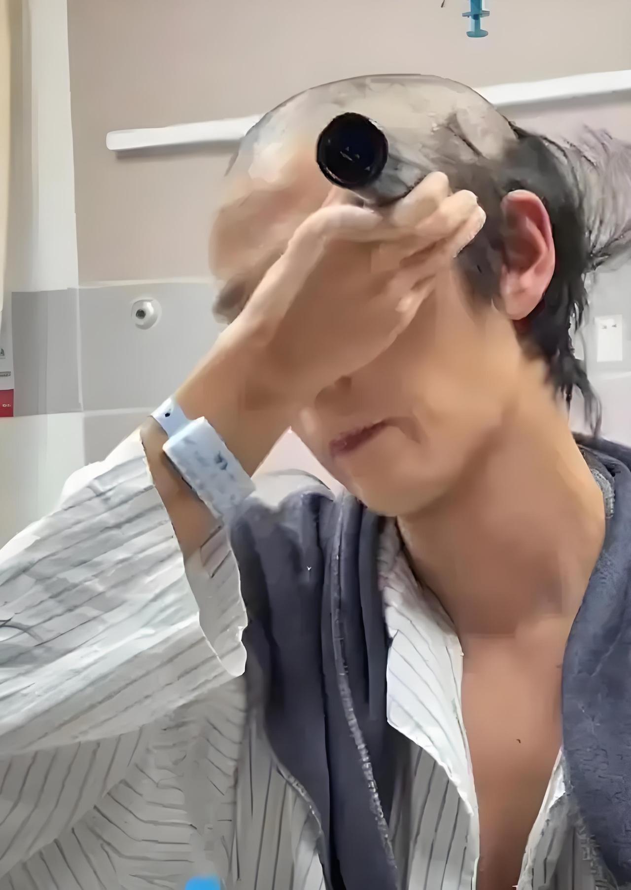 歌手郭聪明被特发性震颤折磨多年，此病源于家族遗传，自12岁起便伴随他，随年龄增长