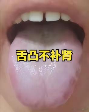 中医舌诊不传之秘：舌凸不补肾，舌淡不疏肝，舌凹不健脾​1.舌凸不补肾肾虚的朋友，