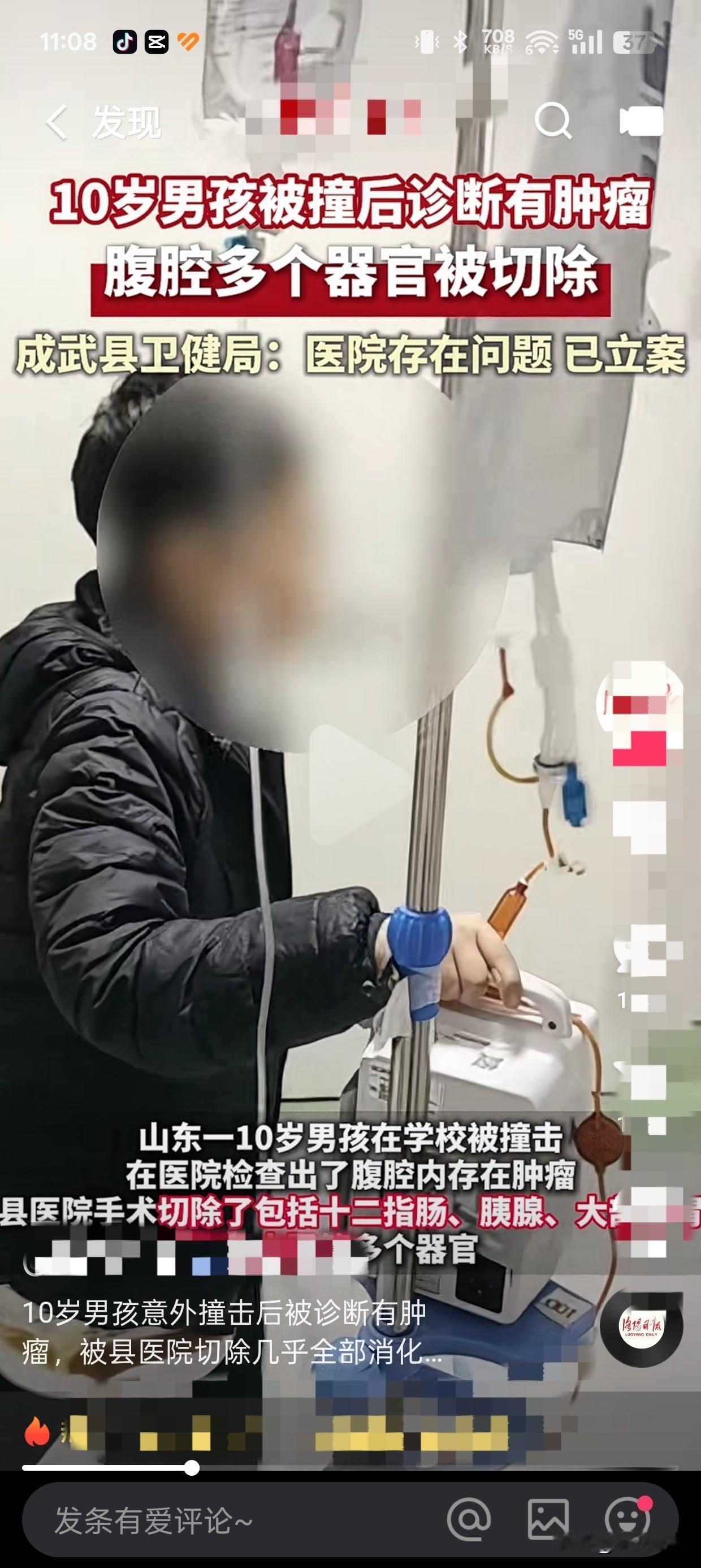 10岁男孩意外撞击后被诊断有肿瘤，被县医院切除几乎全部消化系统
 
当一个10岁