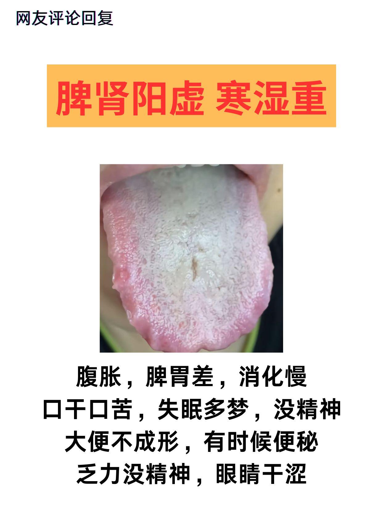 舌诊分析