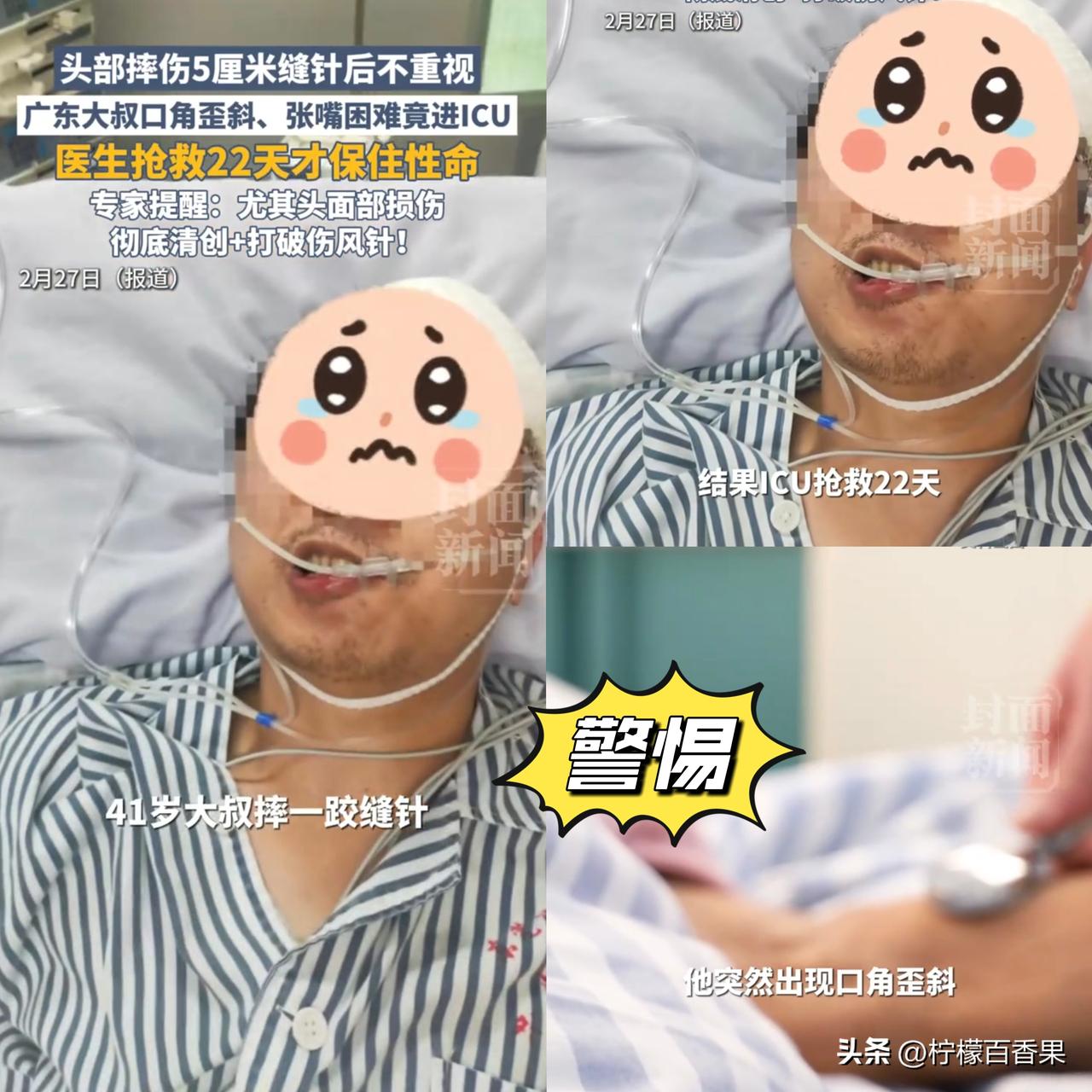 41岁男子摔破头没打这针，ICU躺了22天！
 
东莞41岁的汪先生，5天前不小