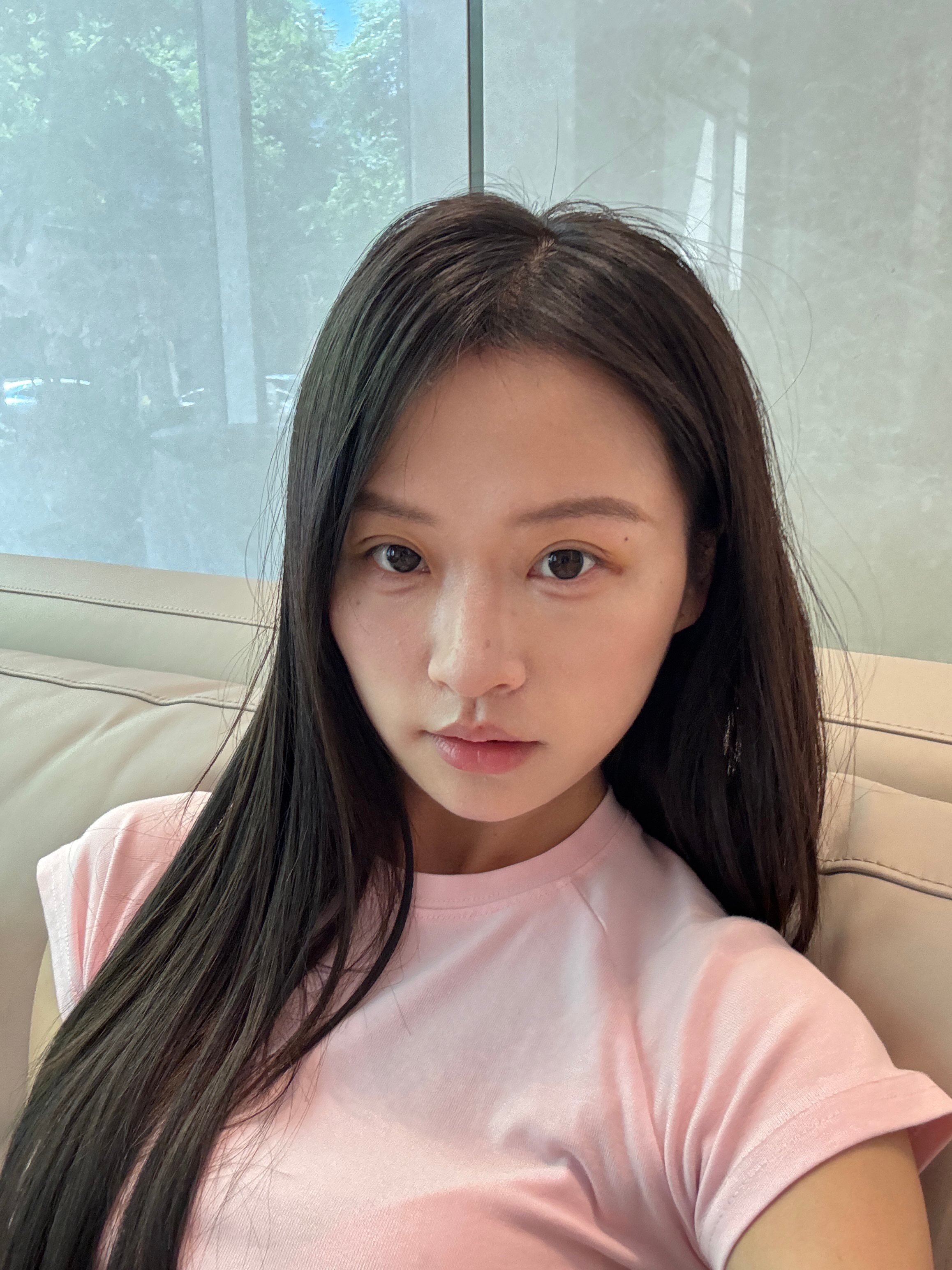 最近没露脸是因为偷偷前几天去加宽了我的眼睛今天是第8天 恢复的还行吧我的日常pl
