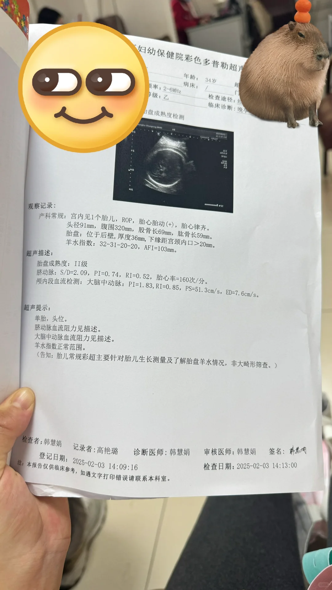 孕36+2，双顶径91，这大头宝宝还能顺产吗