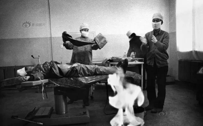 90年代，一名妇女正在做结扎手术，照片中的她躺在手术台上，几名医生拿着手术工具，