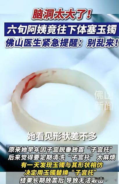 “聪明反被聪明误！”广东，一65岁阿姨因为“阴道异物”去医院检查，结果医生发现里