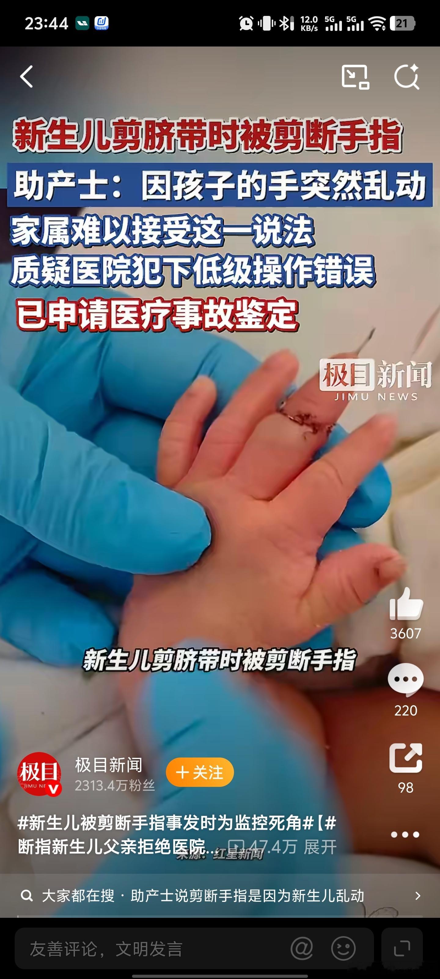 剪断男婴手指助产士已停职断指新生儿父亲拒绝医院10万赔偿心疼这孩子，这伤害不知道