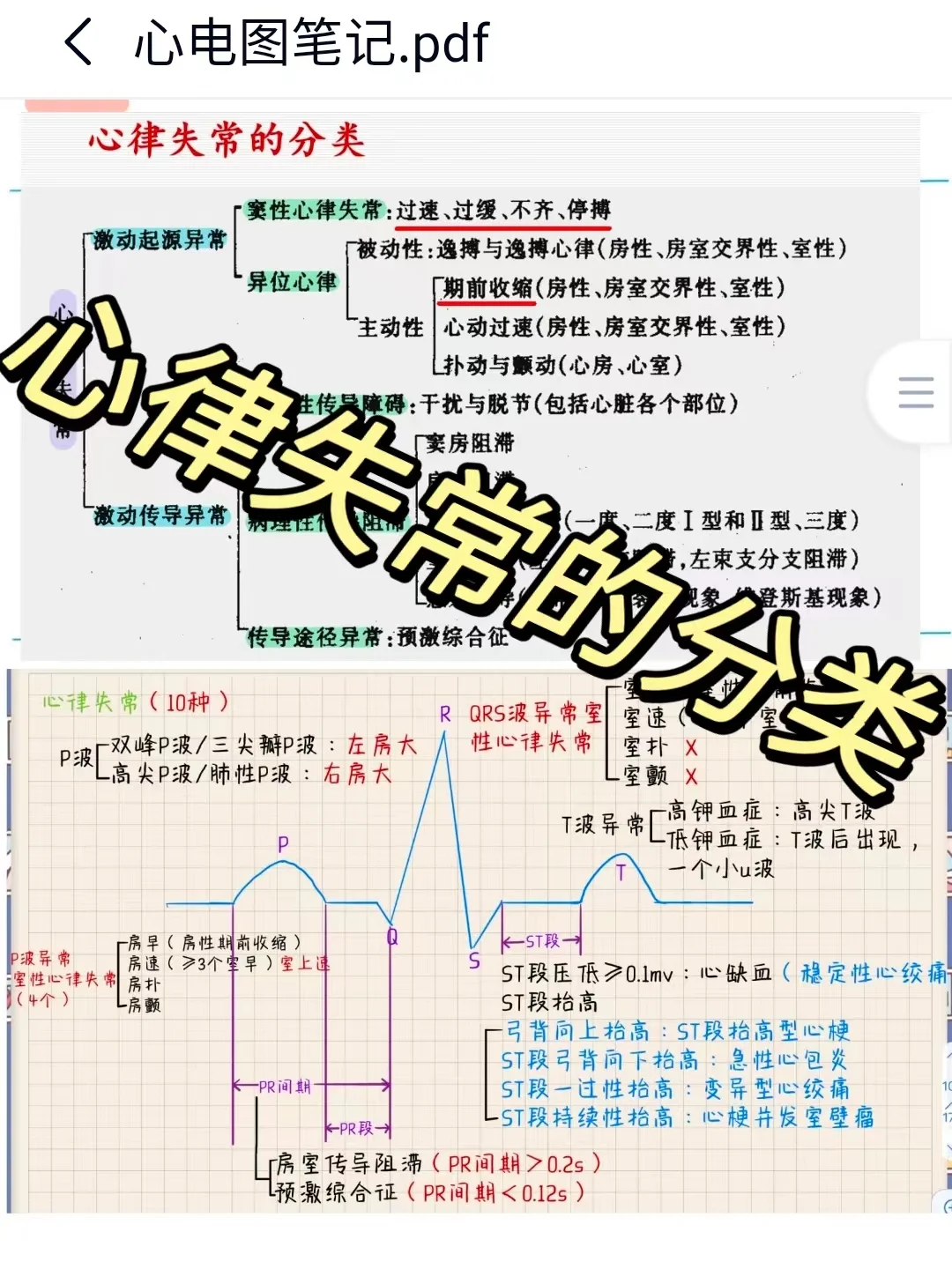 心律失常的心电图分类🔥！！！
