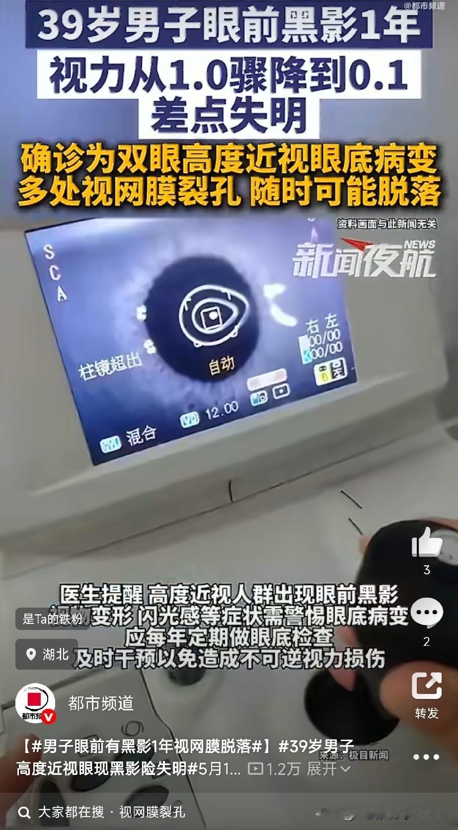 眼前有黑影飘了一年没当回事，39岁男子短短几天视力从1.0暴跌至0.1

有些身