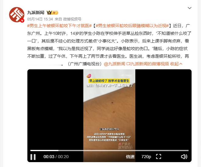 男生上午被银环蛇咬下午才就医 14岁男生在学校被蛇咬了一口，出现手脚发麻视力模糊