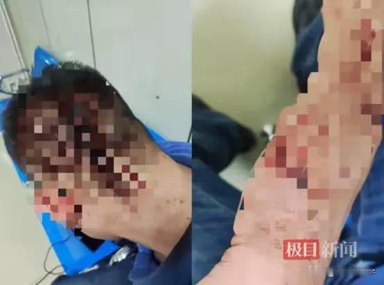💥太原网红店黑幕曝光！卤肉难吃引粉丝“生死对决”？

山西太原，男子薛某140