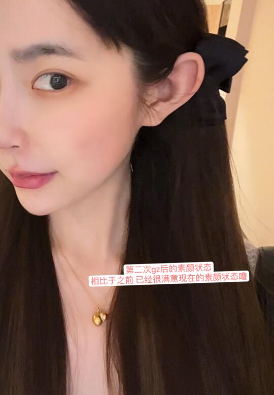 光子第二次后的效果反馈