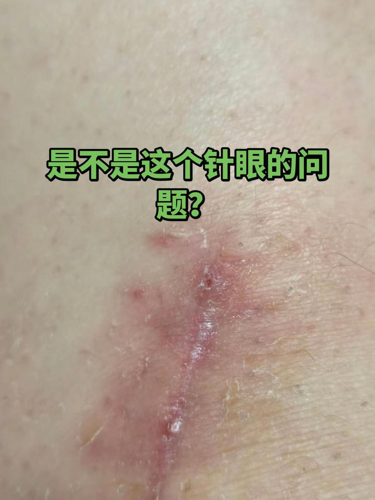 撑不住了，去医院呀！
